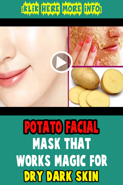Potato Facial Mask That Works Magic For Dry Dark Skin