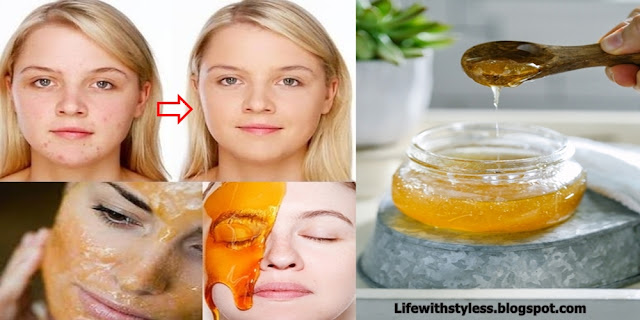 Honey Mask Does Wonders For Your Beauty