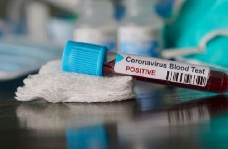 Produsen Obat Asal Inggris Menggarap Vaksin untuk Virus Corona