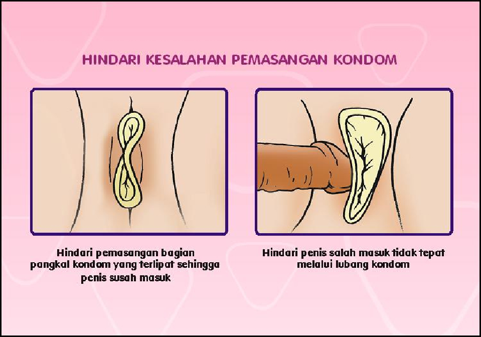 Catatan Liza Mengenal Kondom Wanita Female Condom 