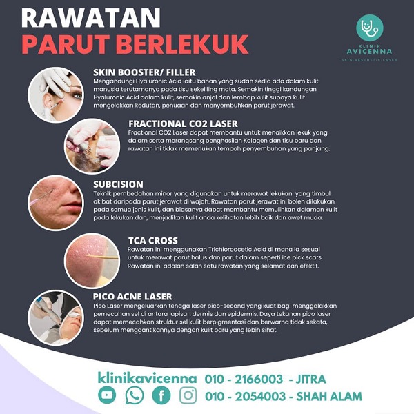 rawatan dermatologi profesional untuk menghilangkan parut jerawat