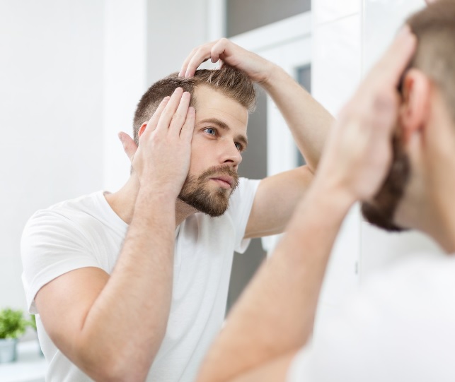 how to stop hair loss without taking finasteride