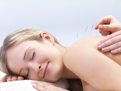 Acupuncture Health Benefits – for Women with Polycystic Ovary ...