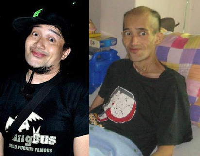 Grin Department's vocalist Bong Piscasio - before and during illness