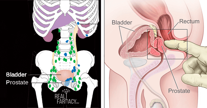 Research Finds Link Between Ejaculation Frequency And Risk Of Prostate Cancer