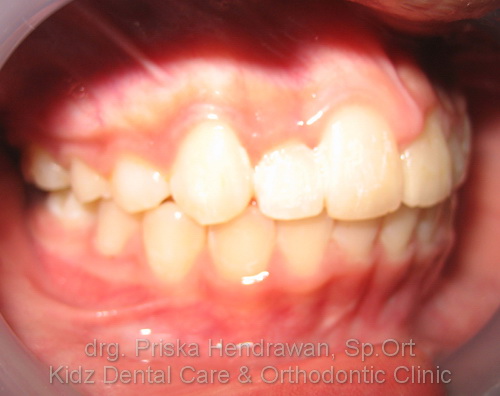 Klinik Gigi Anak dan Behel Gigi Kidz Dental Orthodontic 