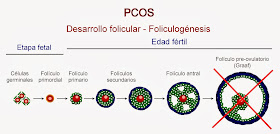 Foliculogénesis alterada en el síndrome del ovario poliquístico