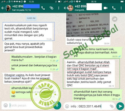 Obat Penghilang Benjolan Di Kepala Belakang Tradisional