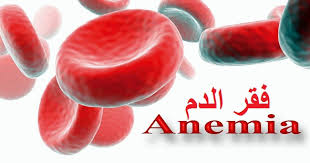 أعراض مرض فقر الدم (الأنيميا) و أسبابه
