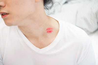 cara menghilangkan bekas cupang ciuman dengan cepat 9 Cara Menghilangkan Bekas Cupang yang Memerah dengan Cepat 