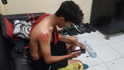 Petugas Polisi Terseret Sepeda Motor Saat Hendak Meringkus Pelaku Narkoba  