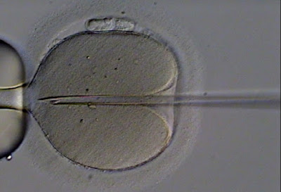 Intracytoplasmic Sperm Injection.