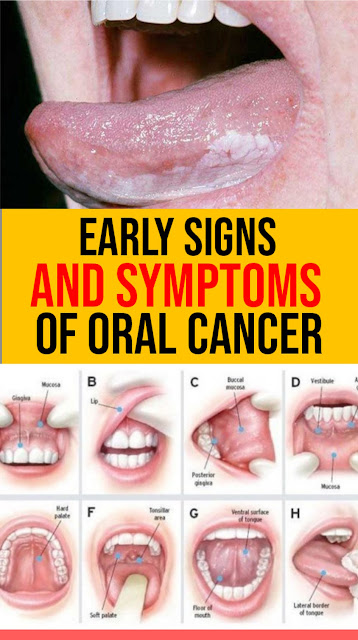 Warning Signs Of Oral Cancer: Are You At Risk?
