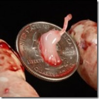 aborto ceras (4)