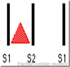 ejection systolic murmur