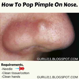 How To Pop Pimple On Nose.