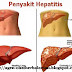 Cara Mengobati Penyakit Hepatitis B Secara Tradisional