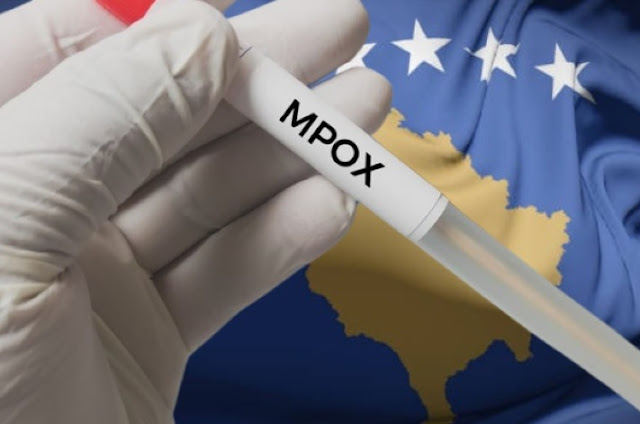 An Mpox test container held by the left hand of a doctor wearing a doctor's glove and the flag of Kosovo in the background