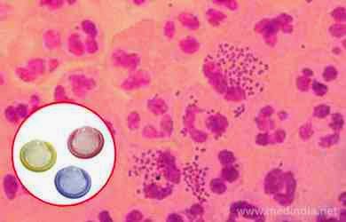 gonorrhea infection causes &  transmission 