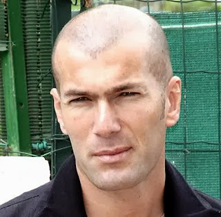 Hairless Hairstyle for Men5