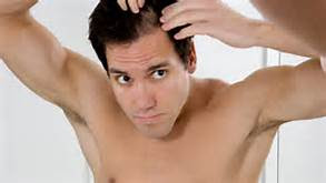 Baldness ,Causes  and Solutions 