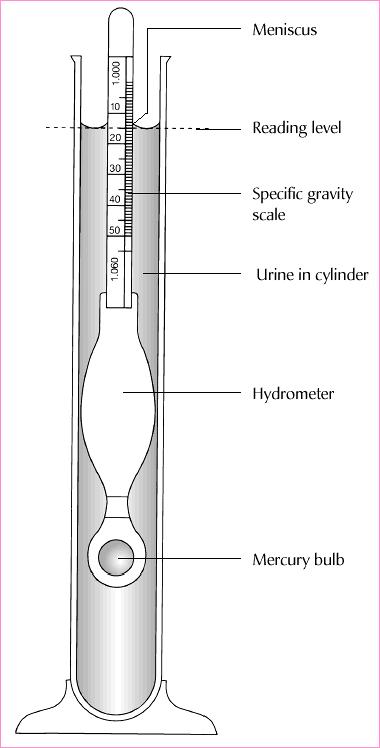 amorphous urate crystals in urine. granules and amorphous amorphous shape between amorphous pellicle upon the urine Also arc often will at Amorphous+urates Quite constant findings were