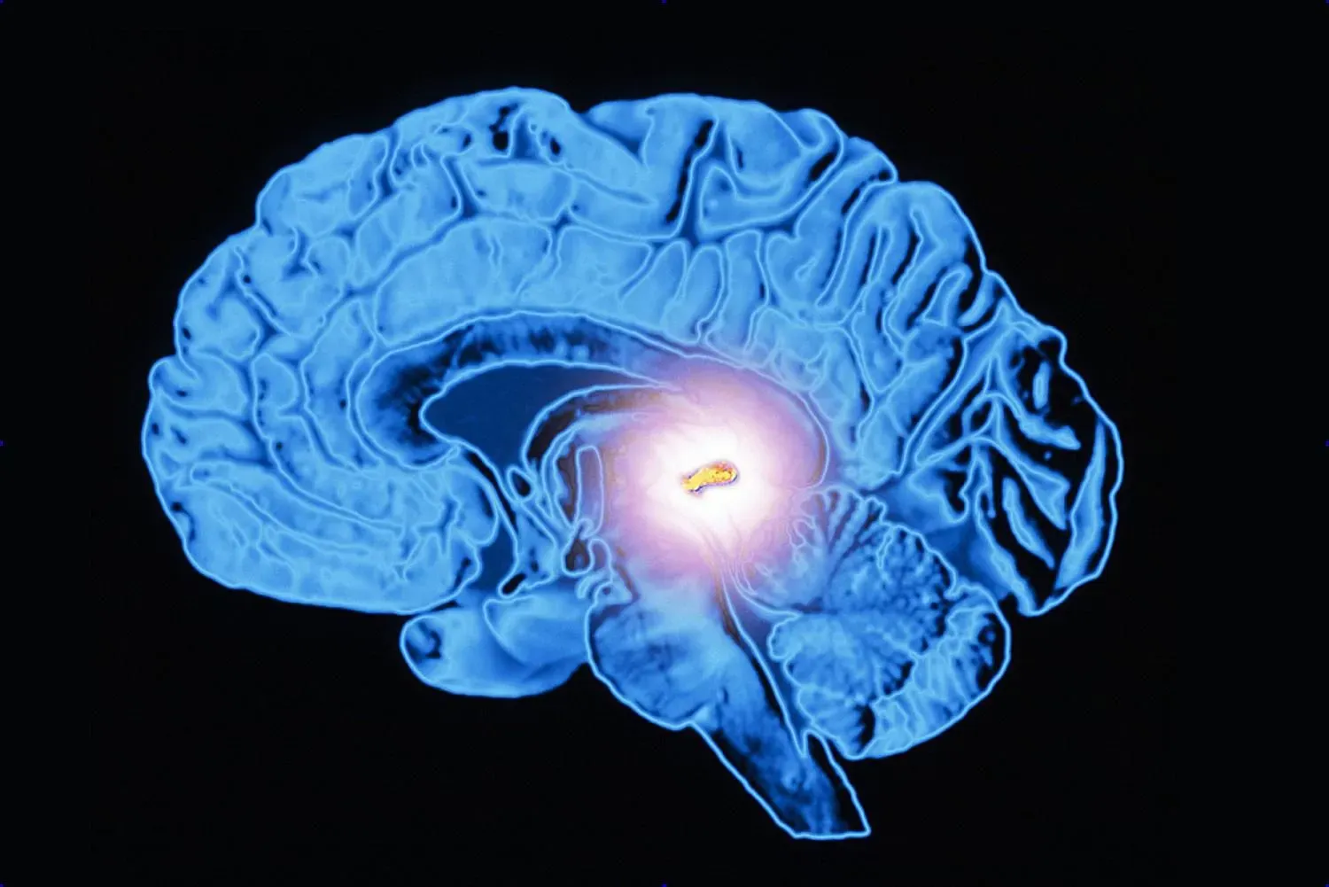 neuroplasticidade