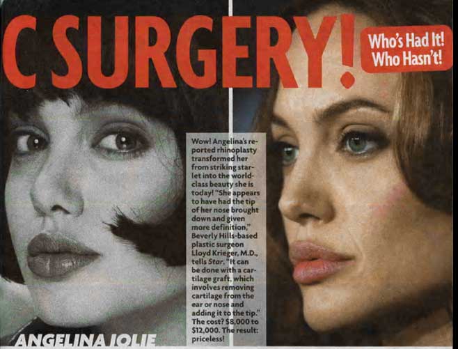 angelina jolie plastic surgery photos. Angelina Jolie: In the name of