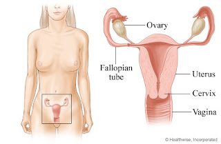 sakit kanser ovari