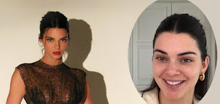 Kendall Jenner Embraces Natural Skin, Revealing Wrinkles and Blemishes Amid Fan Accusations of Plastic Surgery