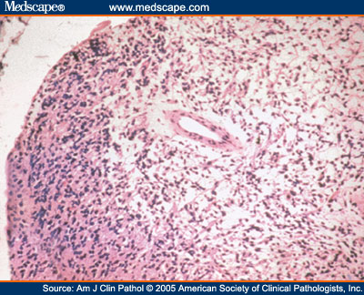  Jaringan  Embrional  BIOLOGIPEDIA