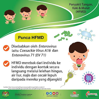 tips atasi penyakit HFMD