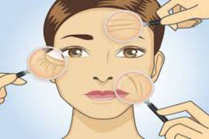 She Removed All Wrinkles With This Homemade Cream In Just 1 Week (Recipe)