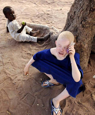 Albino People Eyes. of the albino in Tanzania.