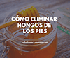 Remedios para eliminar los hongos de los pies