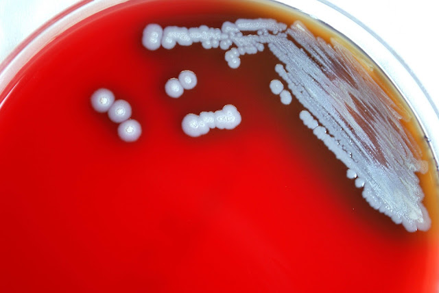 Burkholderia Infections