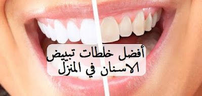 أفضل خلطات تبييض الاسنان