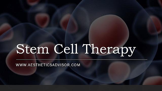 stem cell therapy