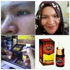 JUAL SUPER NANO PROPOLIS