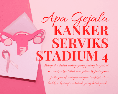 Apa Gejala Kanker Serviks Stadium 4