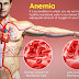 4 Cara Pengobatan Anemia