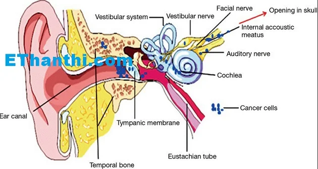 காது கேட்கும் திறனை பாதிக்கும் நோய்கள் !