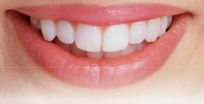 Có nên bọc răng sứ zirconia không?