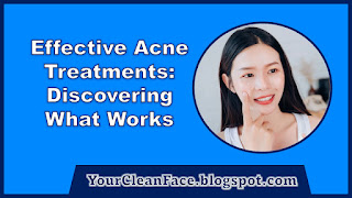 Effective Acne Treatments: Achieving Clear Skin Naturally