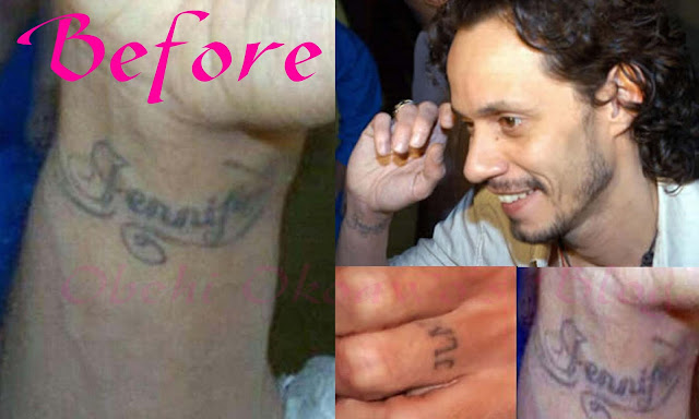 Marc Anthony Removes All Traces Of J. Lo's Tattoo From His Body