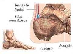 calcanhar3