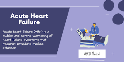 Acute heart failure (AHF) is a sudden and severe worsening of heart failure symptoms