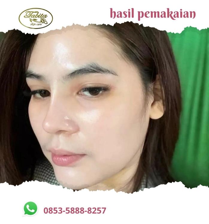 Perubahan Wajah Tabita Skin Care