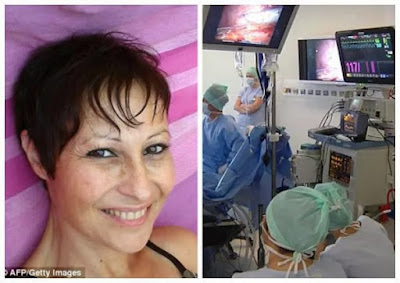 woman has Robot transplant kidney 