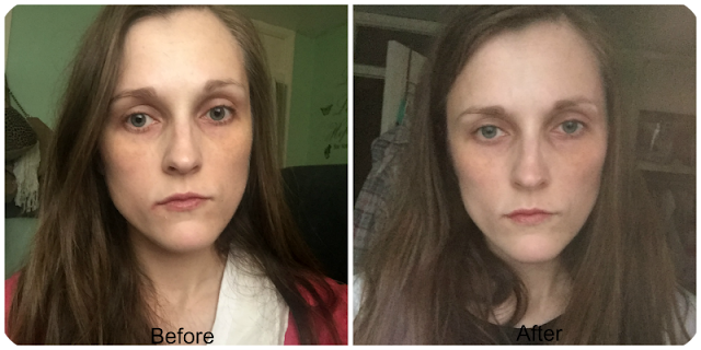 before and after herbalife line minimising serum